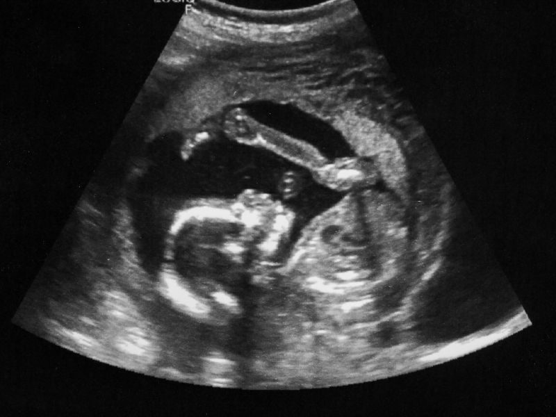 Deep Dive Review of the Current Imaging Workforce in England with a Responsibility for Obstetric Ultrasound Delivery